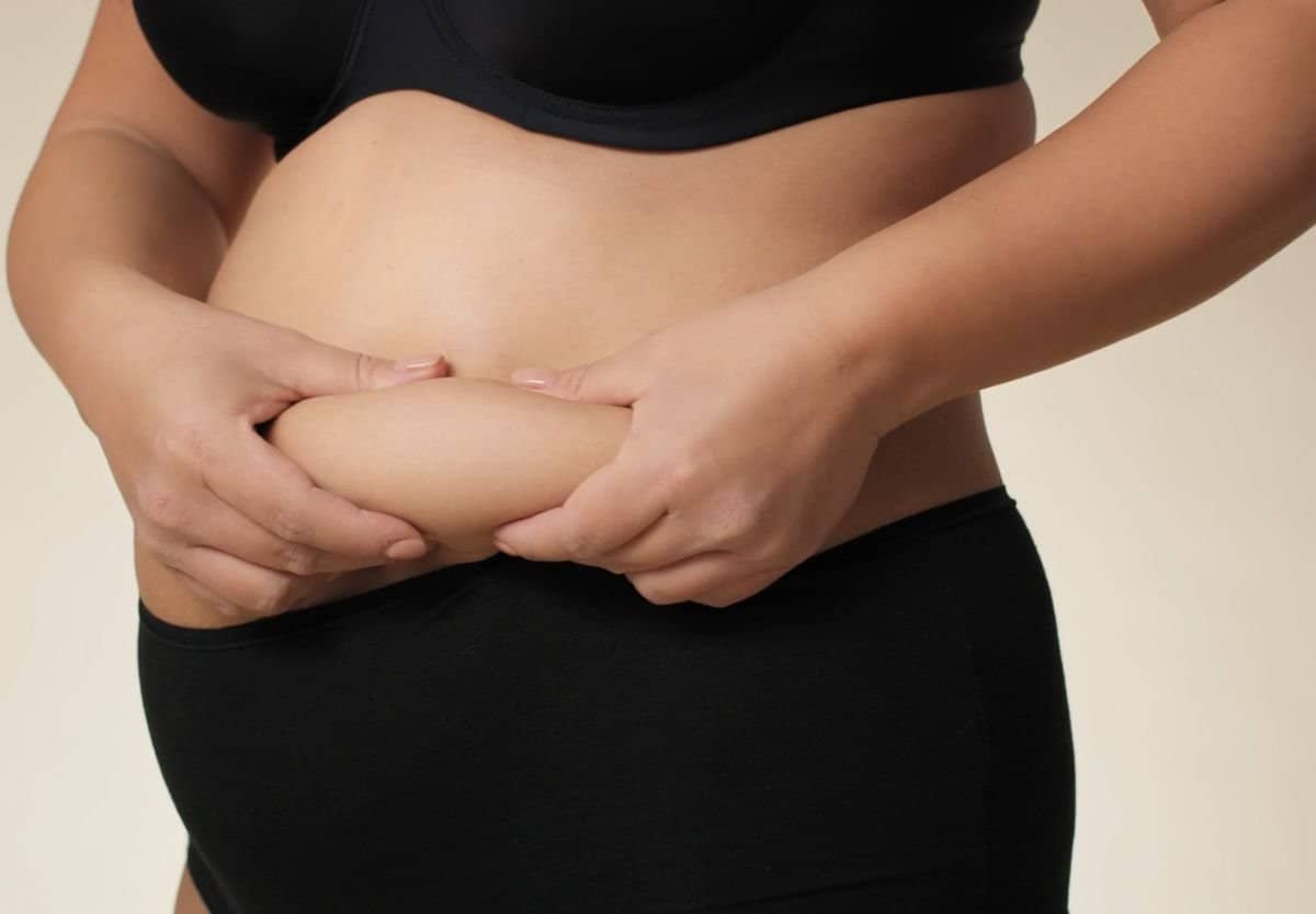 Šta je abdominoplastika