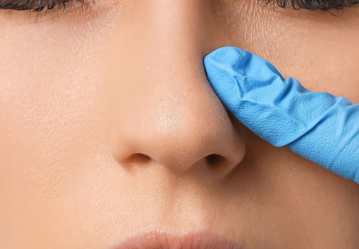 kandidat za operaciju nosa rinoplastiku novi sad