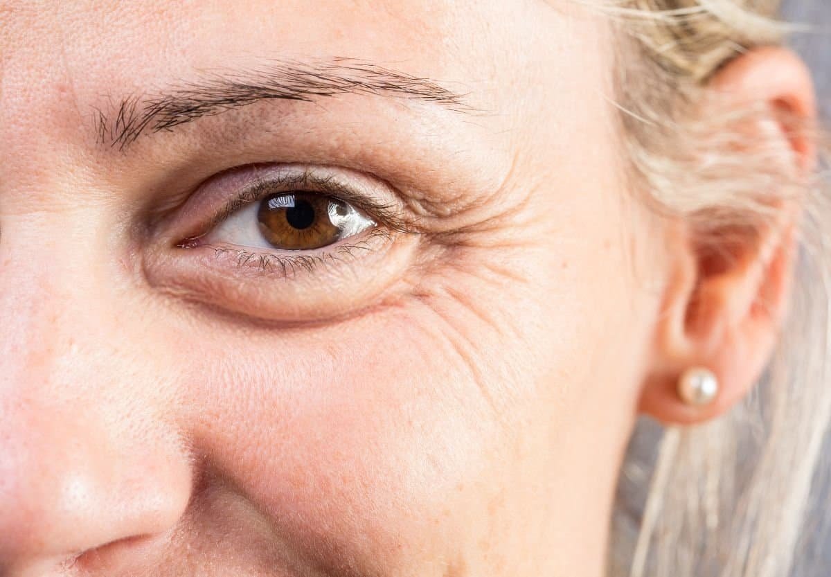 blefaroplastika operacija donjih kapaka podocnjaka novi sad